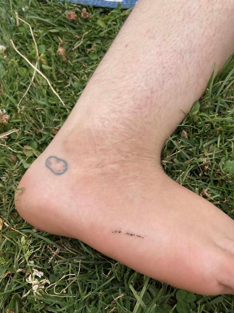 A foot with a potato tattoo on the ankle, as a reference to Sideways Stories from Wayside School.